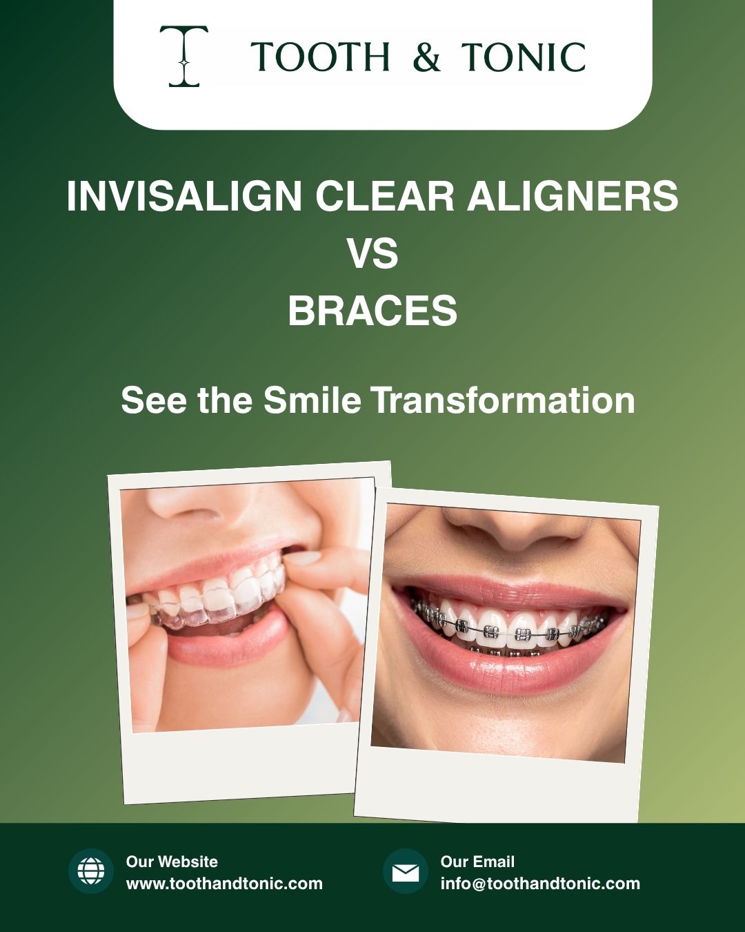 Invisalign Clear Aligners vs Braces: Which Orthodontic Treatment is Best for Your Smile?