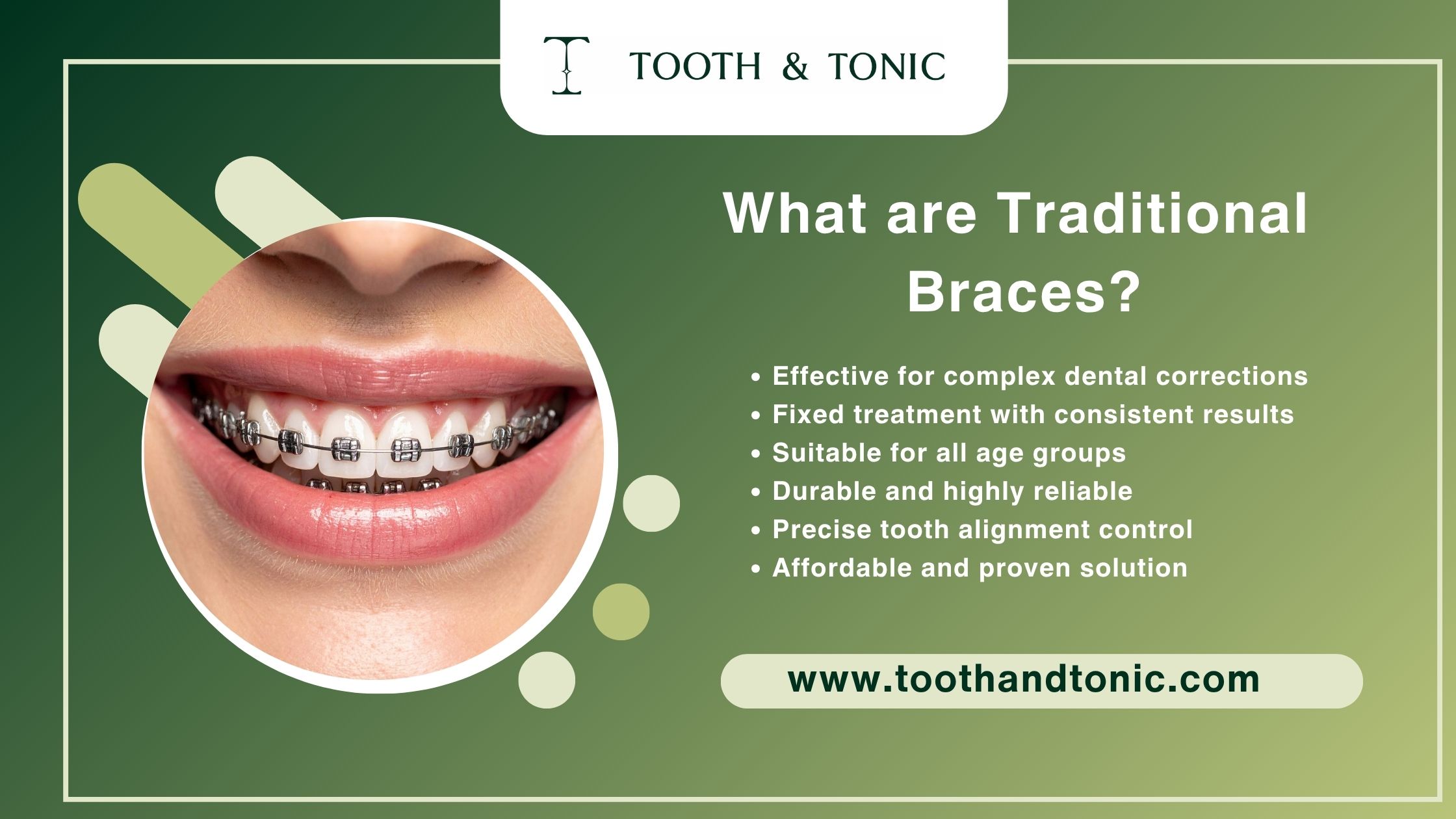 What are Traditional Braces?