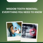 Wisdom Tooth Removal