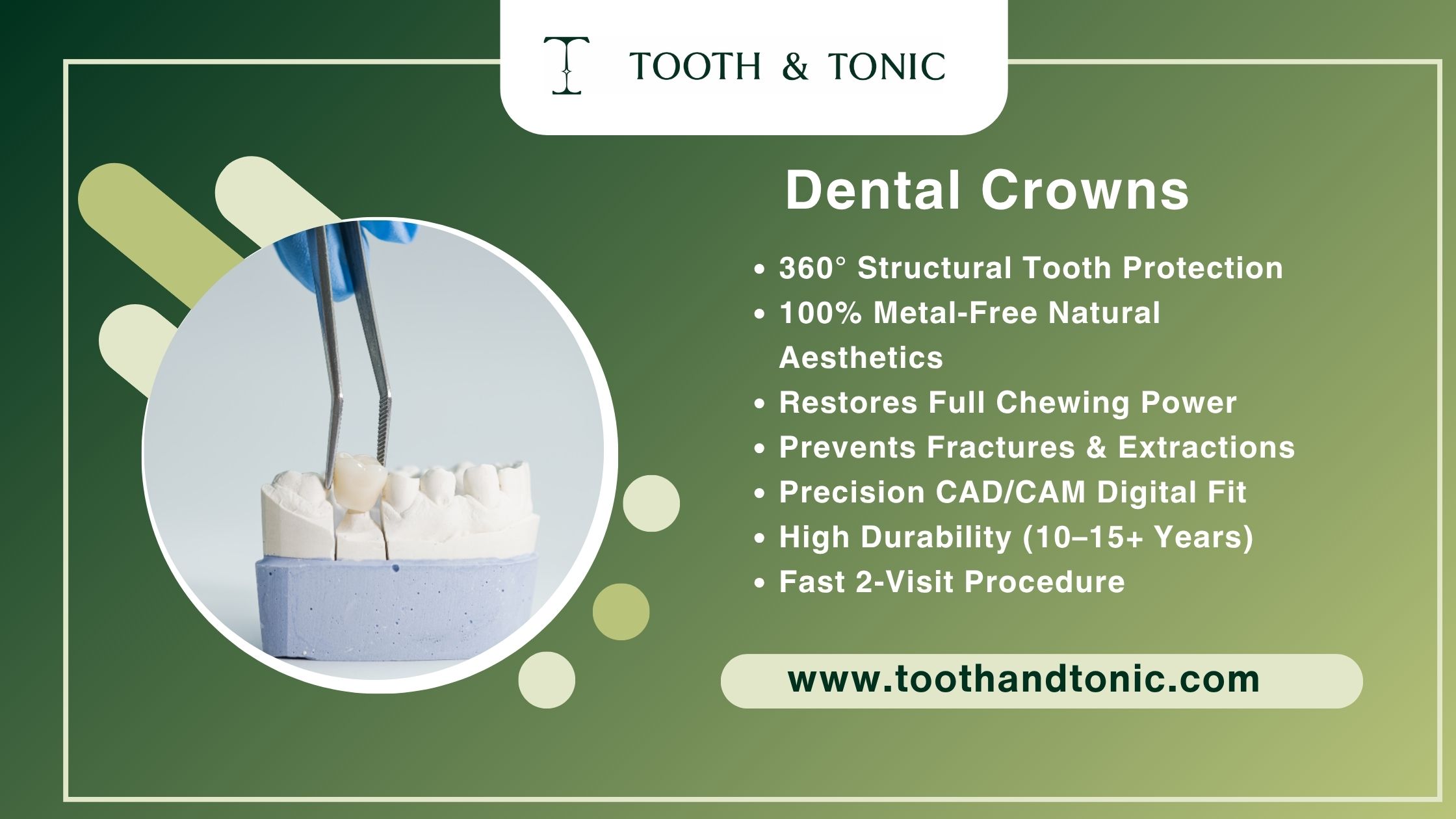 Dental Crowns vs Bridges: What's the Difference?