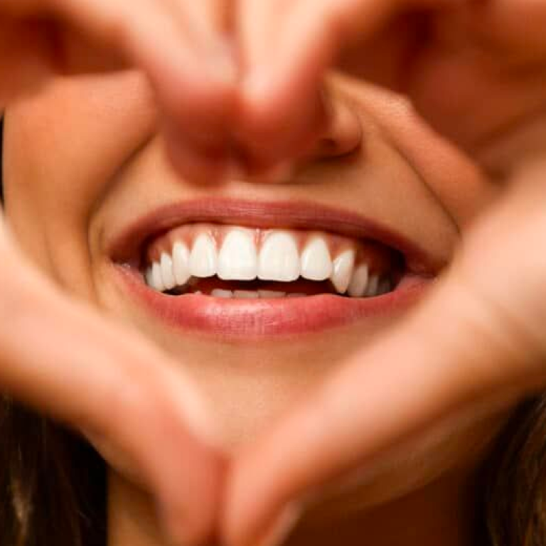 Smile Designing