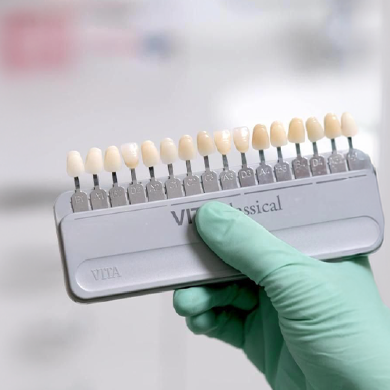 Teeth Whitening