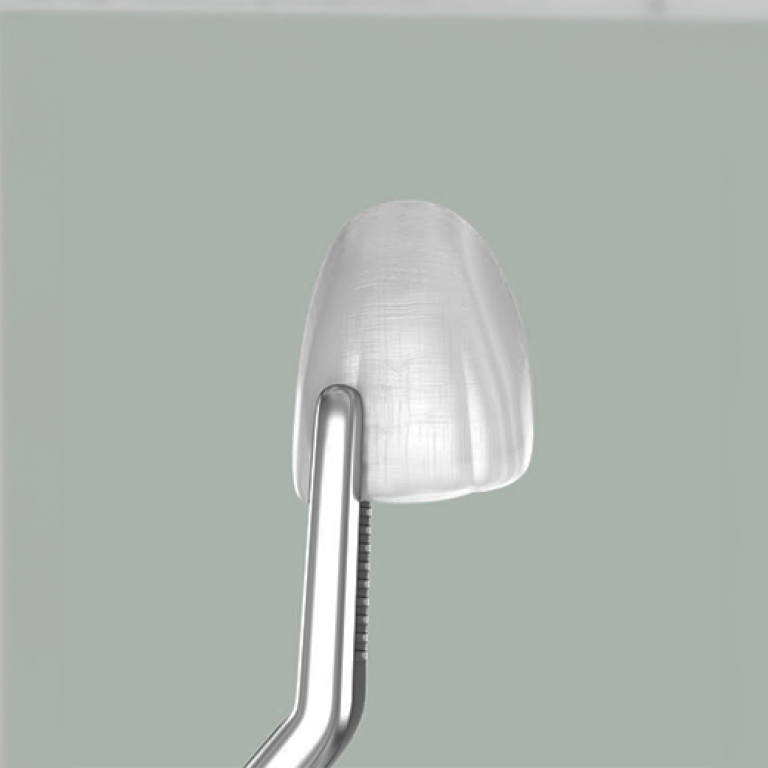 Veneers