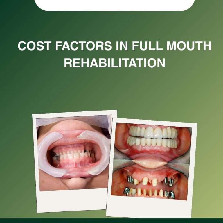 Cost Factors in Full Mouth Rehabilitation