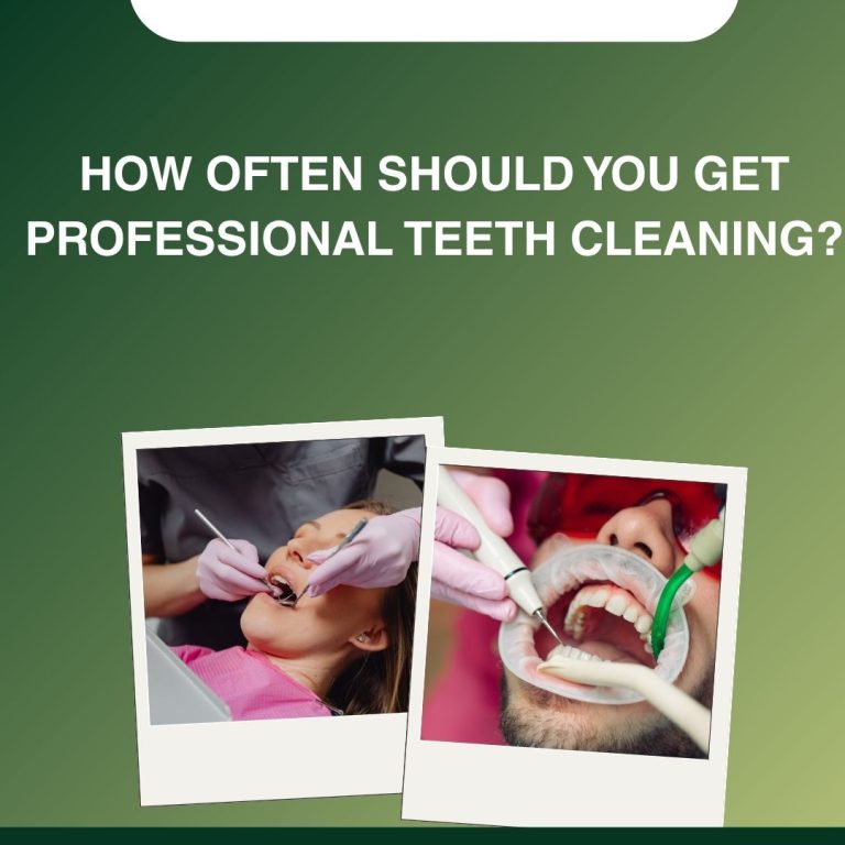 How Often Should You Get Professional Teeth Cleaning?