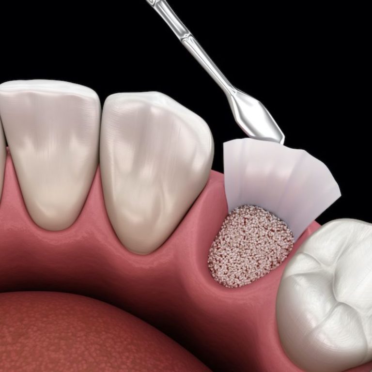 ORAL SURGERY