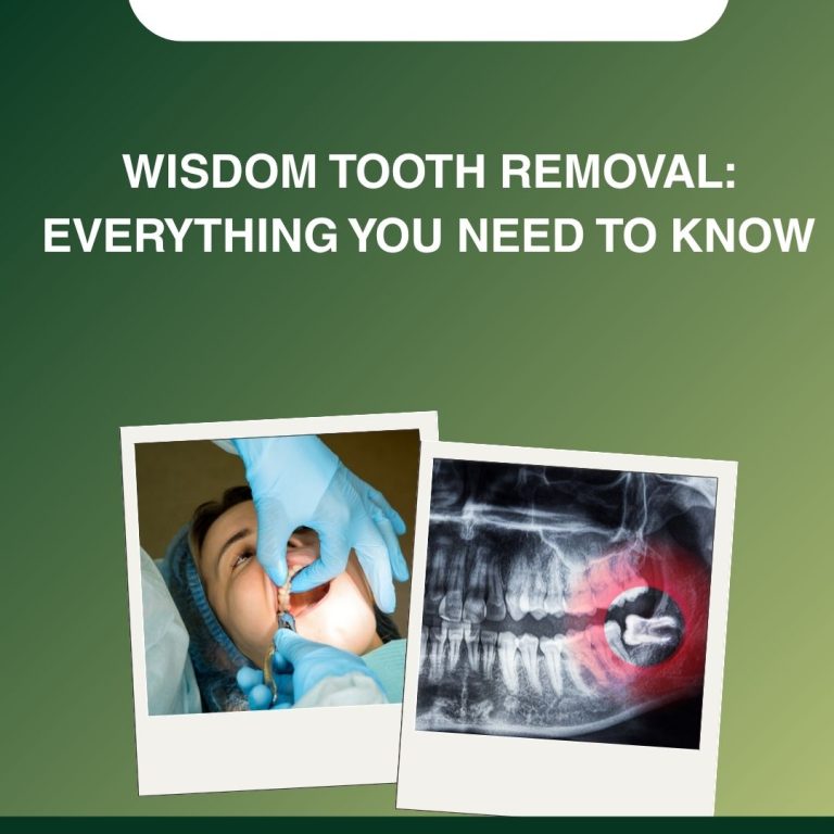 Wisdom Tooth Removal
